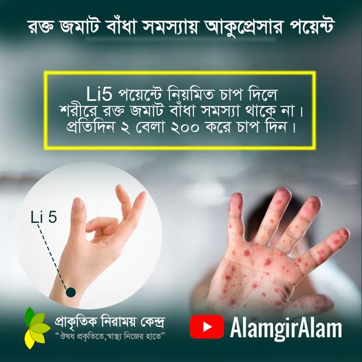 রক্ত জমাট জনিত সমস্যা থাকলে কি করবেন ?